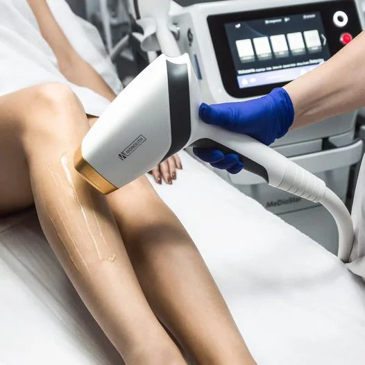 Zabieg laserowej depilacji wykonywany przez specjalistkę w Bielsku-Białej