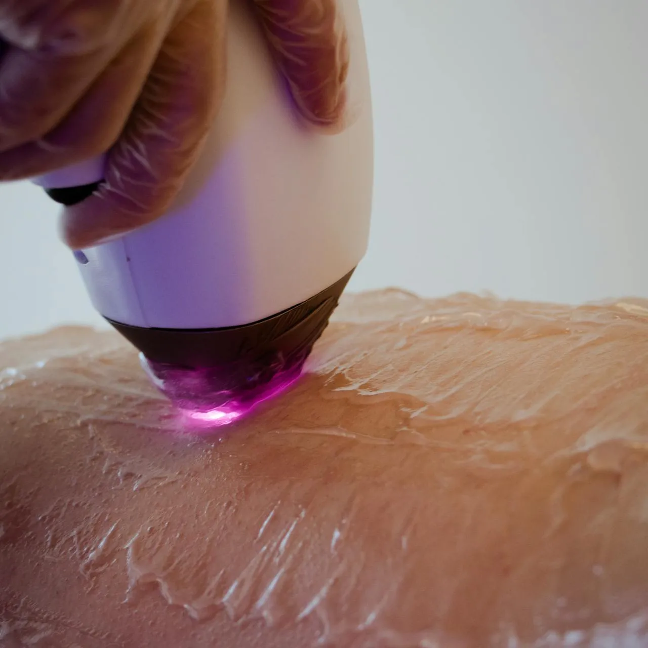 zalecenia przed i po zabiegu depilacji laserowej