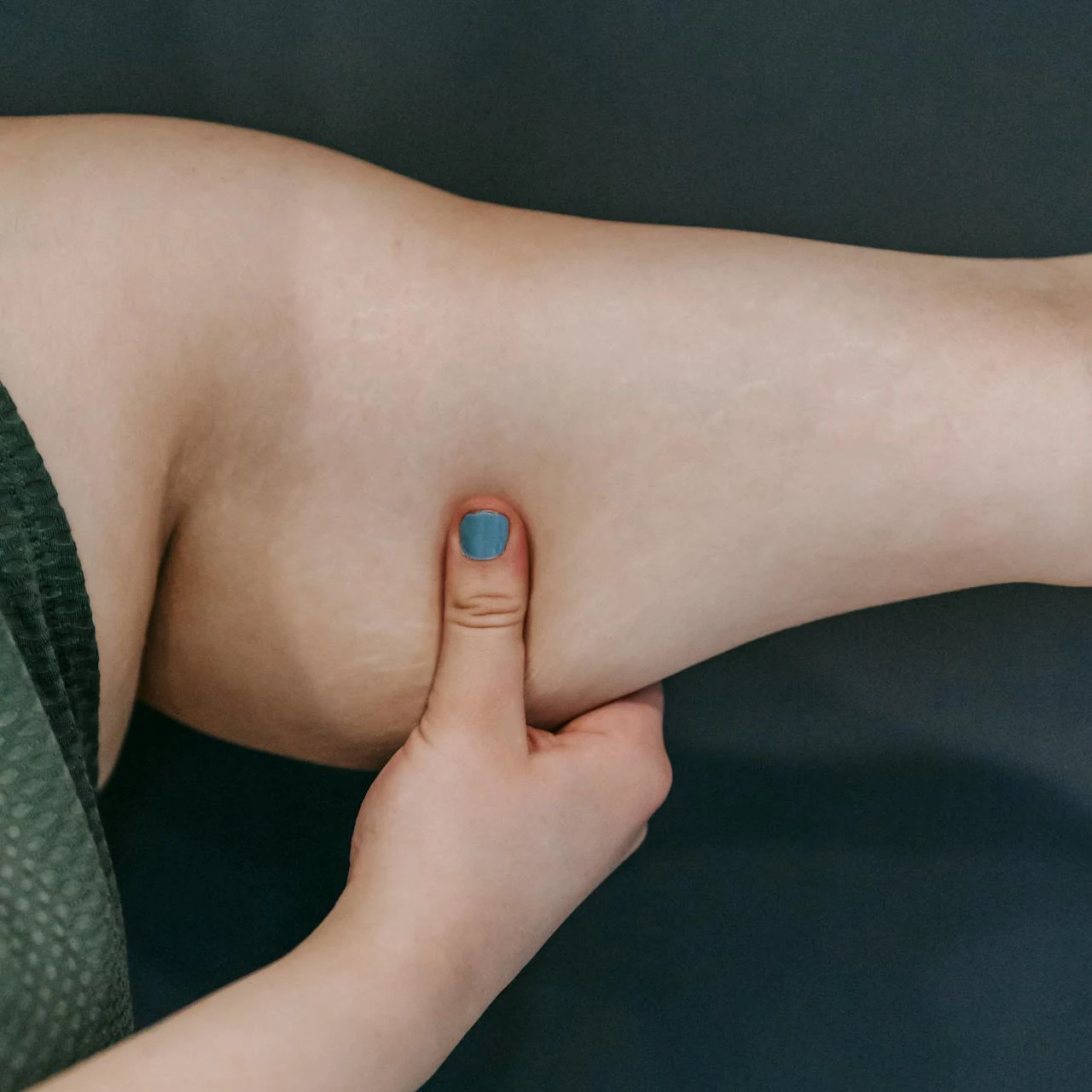 pelikany - tłuszcz na ramionach - wskazania do zabiegu drenażu limfatycznego